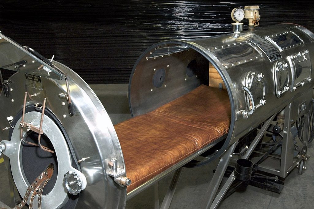 10 Unbelievable Details Surrounding Paul Alexander, Whose Lived In An